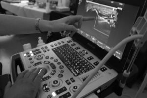 Sonografie hybného systému 2.0