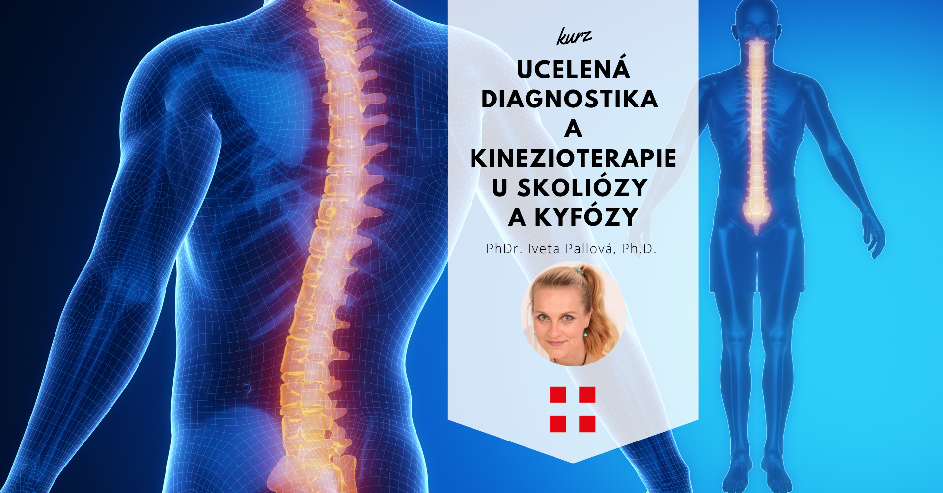 Ucelená diagnostika a kinezioterapie u skoliózy a kyfózy – část 1